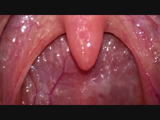 throat and uvula close up